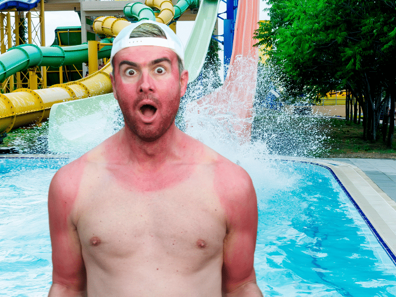 Sunburned shirtless man stand sunburned in front of waterslide. He forgot sun safety is cruise safety.