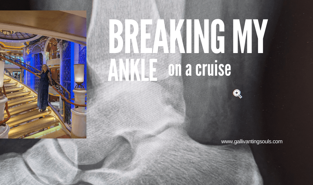 Breaking my ankle on a cruise in Mexico
